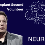 Elon Musk's second neuralink experiment